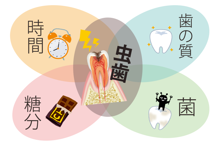 むし歯の原因